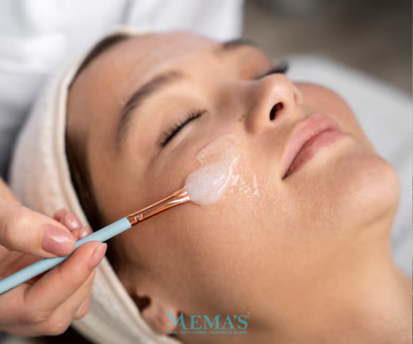 Hollywood Facial Glow at Memas Clinic.