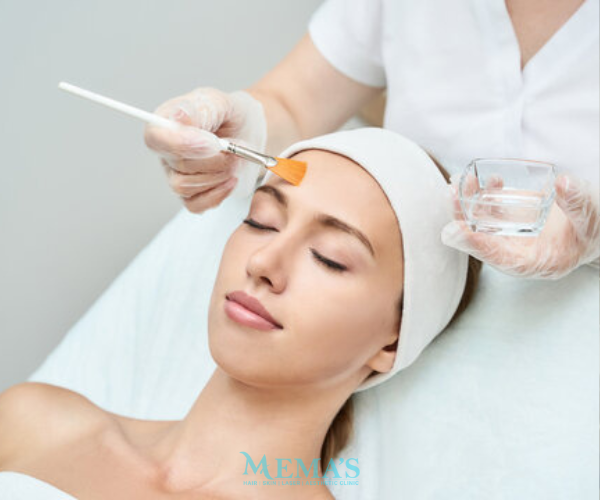Reveal Fresh Skin with Chemical Peels at Memas Clinic.