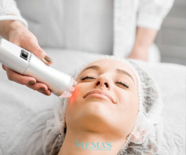 Even-Toned Glow with Laser Toning at Memas Clinic