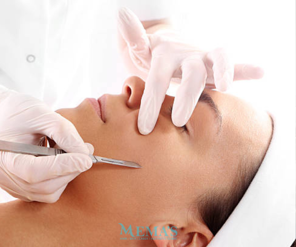 Smooth, Silky Skin with Dermaplaning at Memas Clinic.