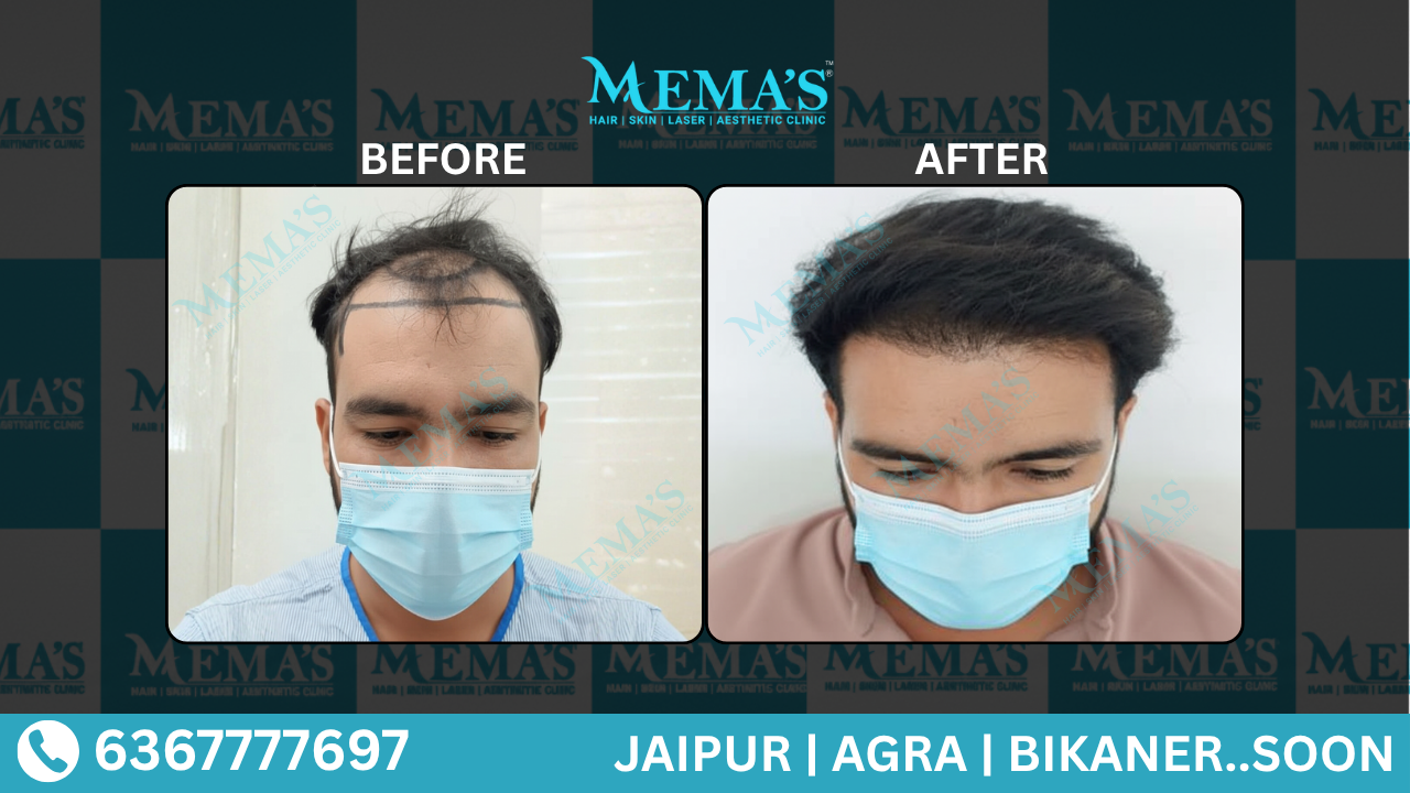 Memas Clinic Hair Care Results