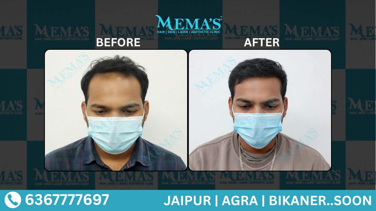 Memas Clinic Hair Care Results