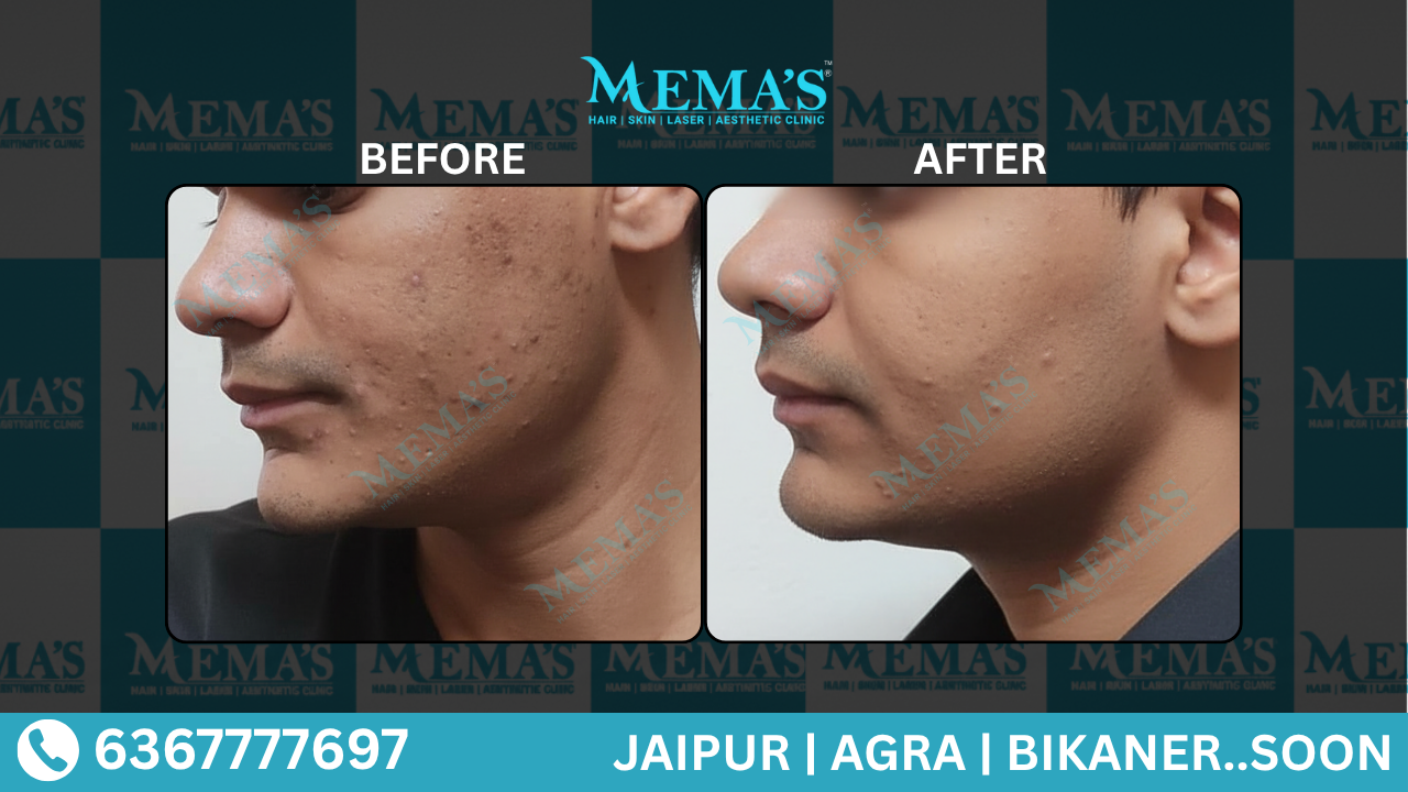 Skin Care Results