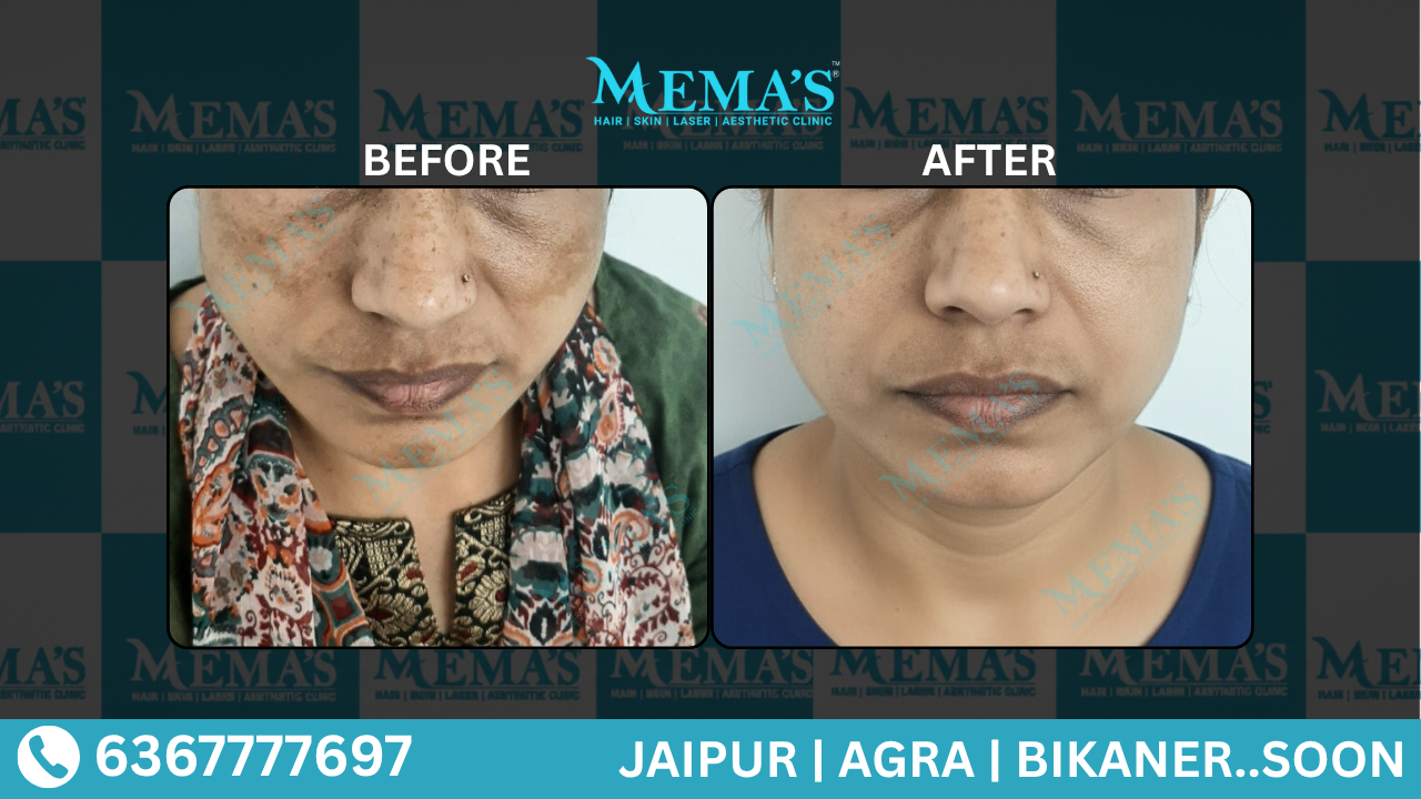 Skin Care Results