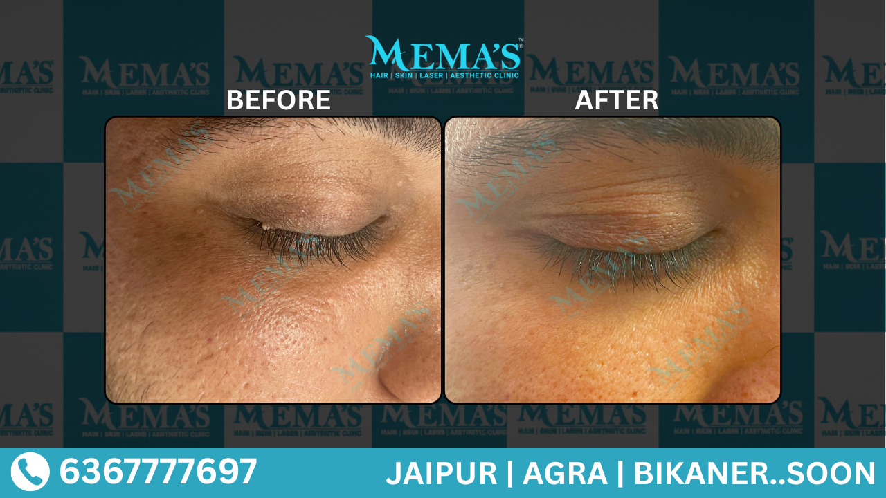 Skin Care Results