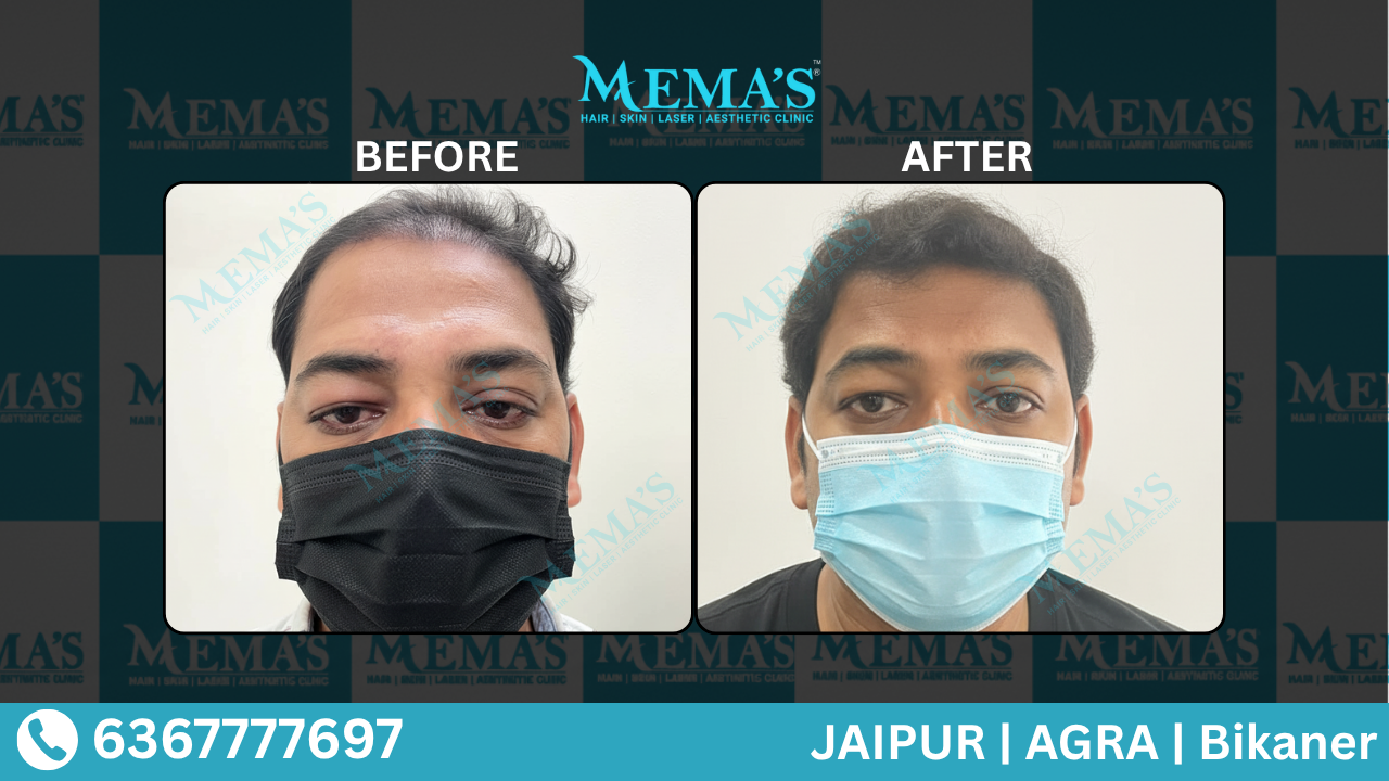 Memas Clinic Hair Care Results