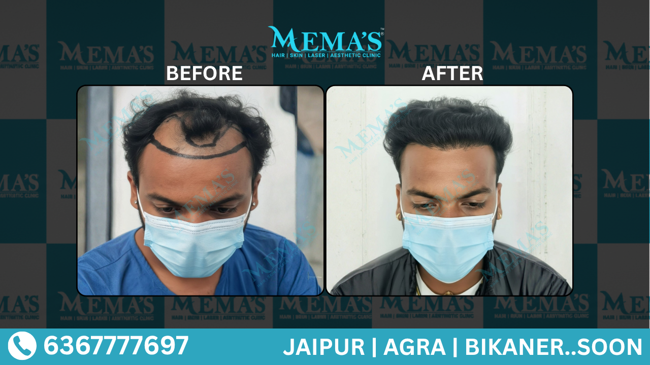 Memas Clinic Hair Care Results