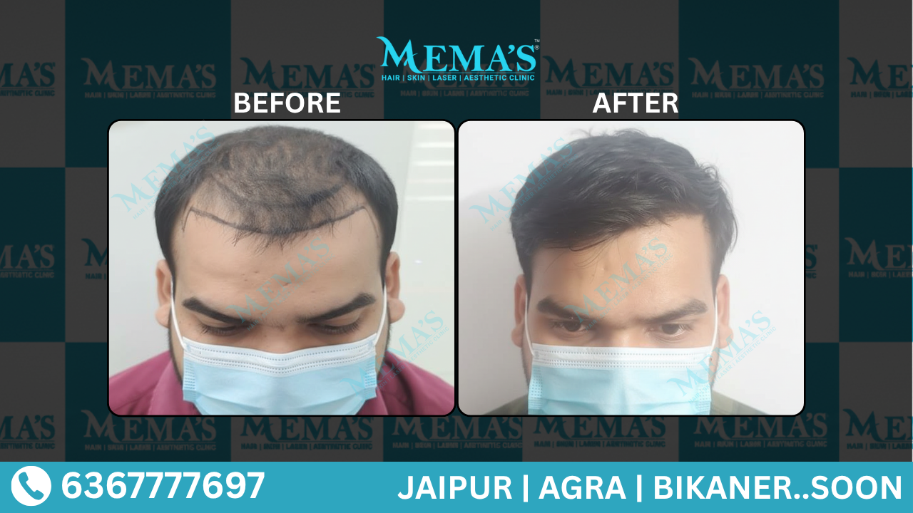 Memas Clinic Hair Care Results