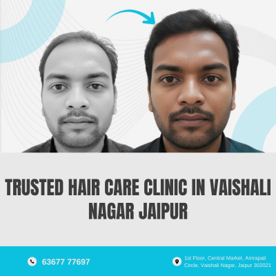 Memas Clinic: Best Hair Care Clinic in Vaishali Nagar Jaipur