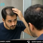 Hair transplant clinic in Jaipur consultation room