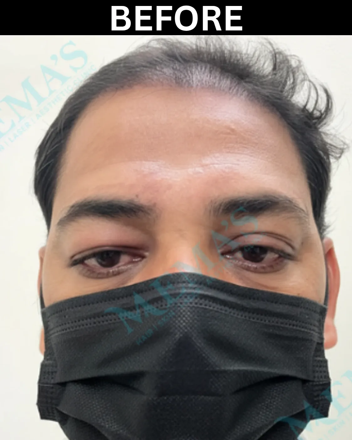 Hair treatment patient result